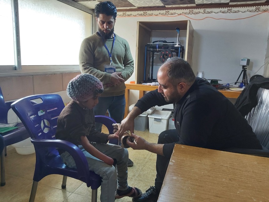 A man gives a prosthetic arm to a child in a clinic