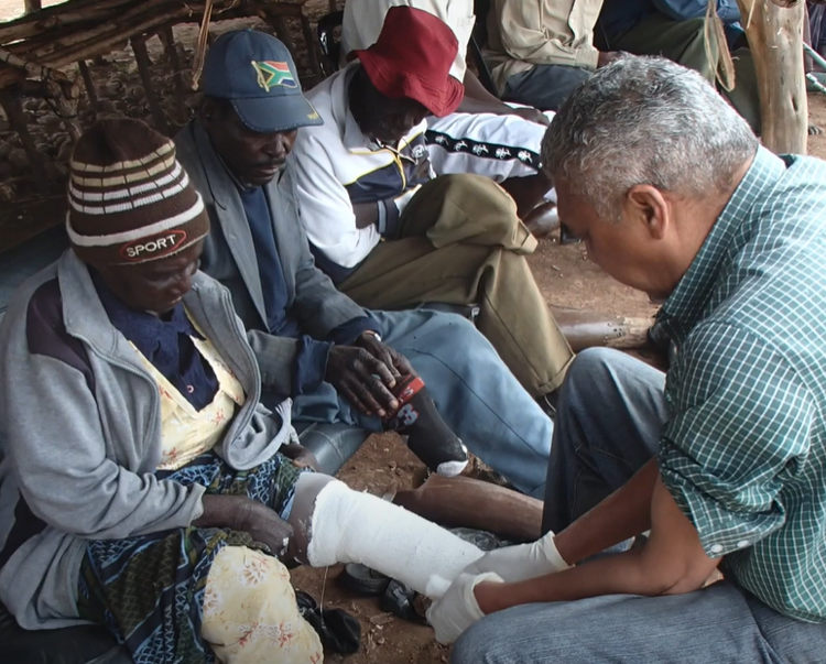 Landmine survivors receiving support in Zimbabwe